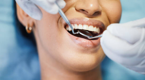 Best Dentist for Tooth Abscess  in Strasburg, OH